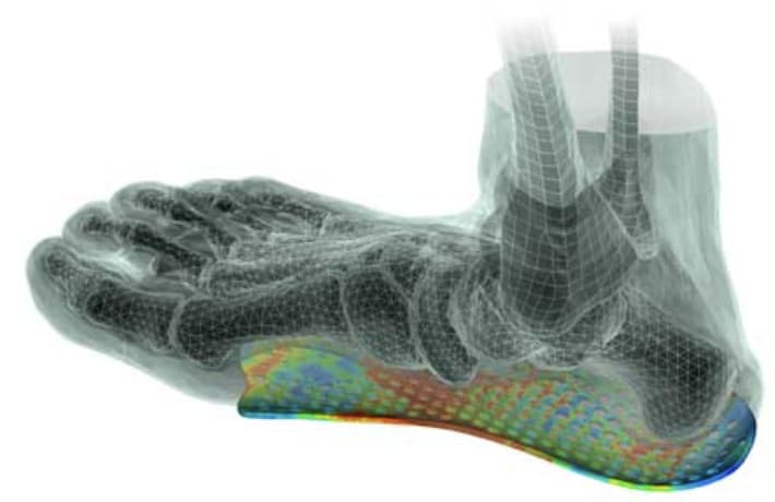 Modélisation 3D d’un pied posé sur sa semelle, zones d’appui en couleur